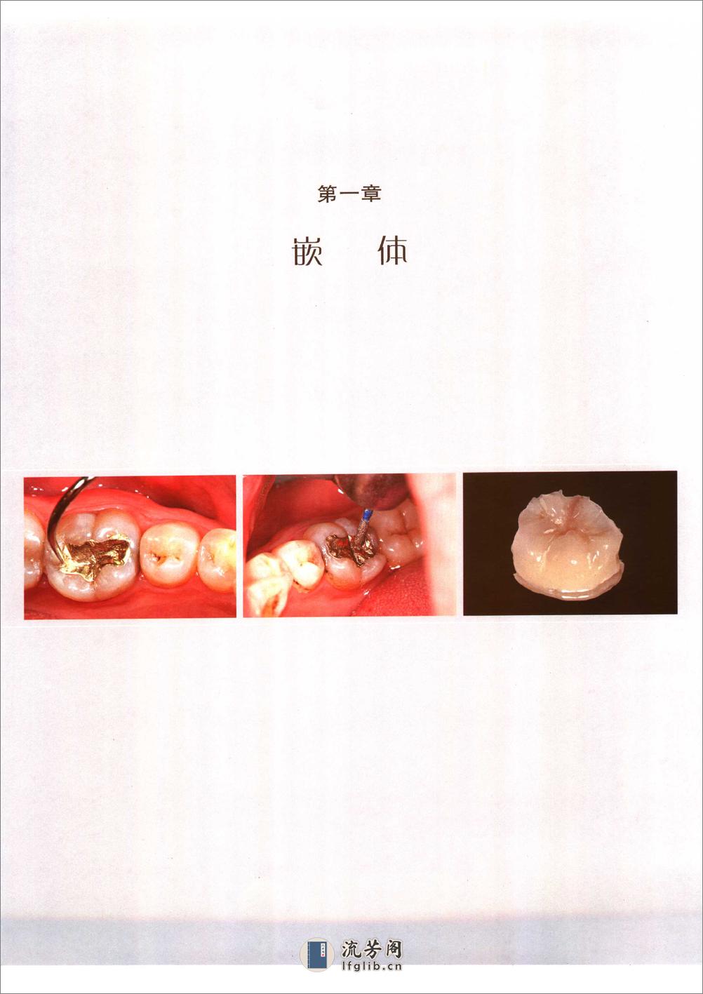 口腔固定修复的临床设计 - 第8页预览图