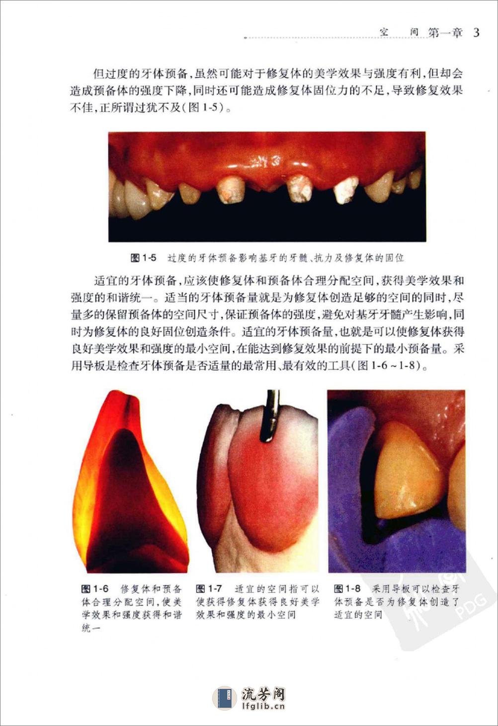 美学修复牙体预备 - 第13页预览图