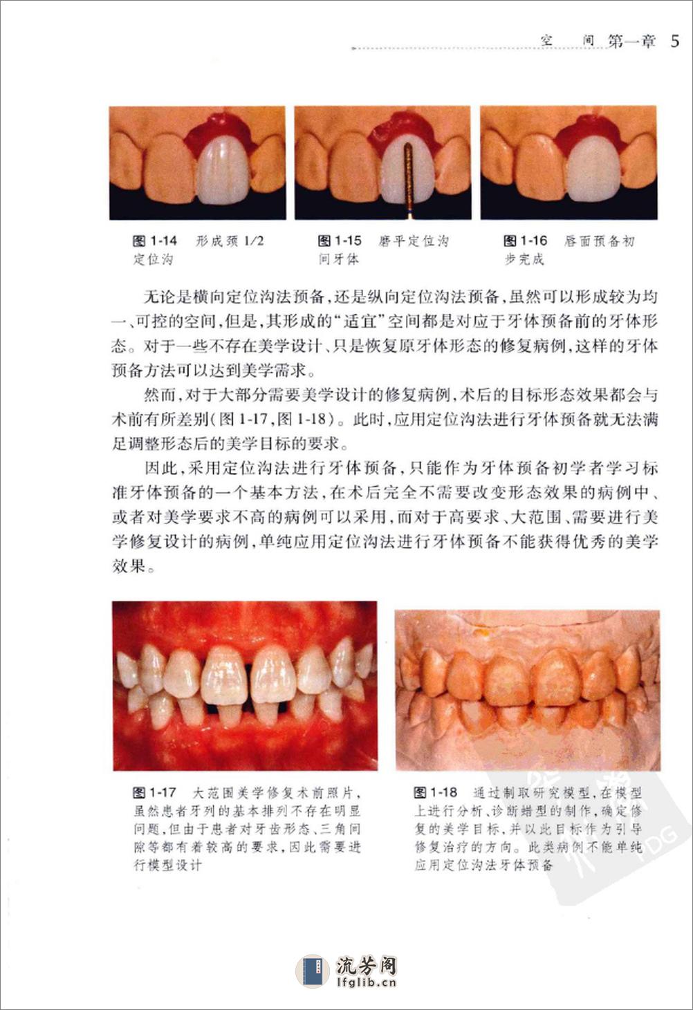 美学修复牙体预备 - 第15页预览图