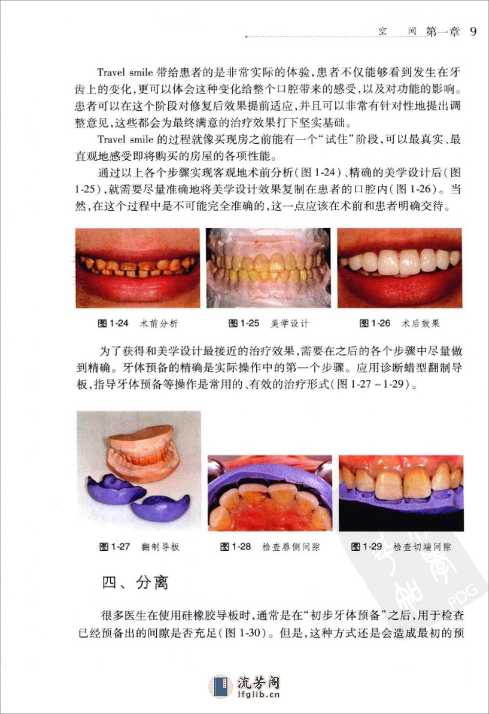 美学修复牙体预备 - 第19页预览图