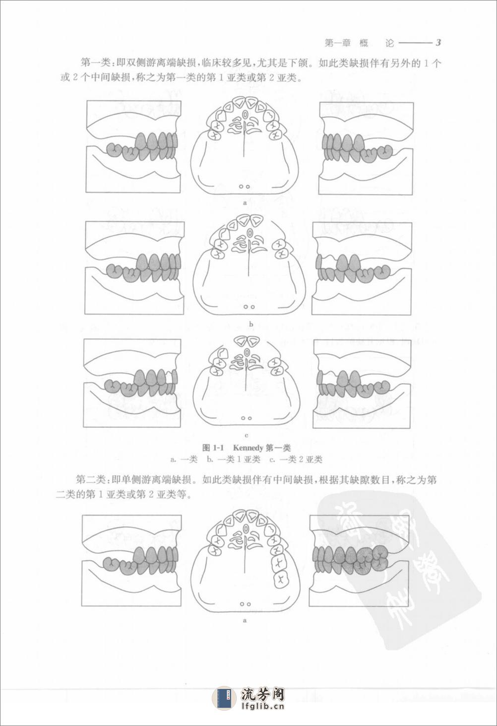 可摘局部义齿修复工艺技术 - 第16页预览图