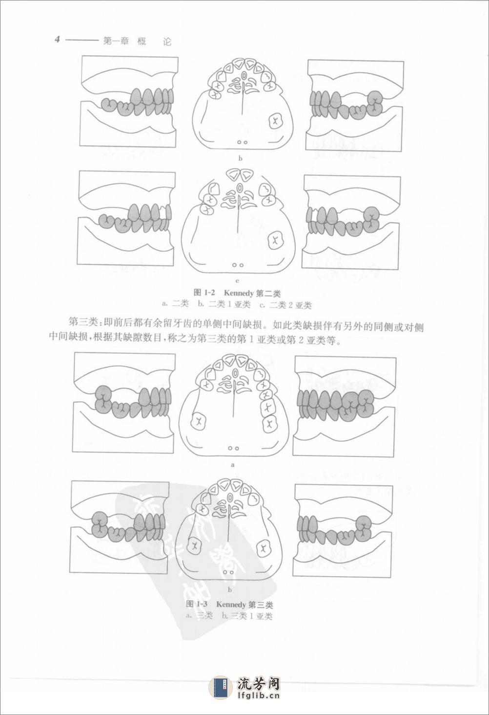 可摘局部义齿修复工艺技术 - 第17页预览图