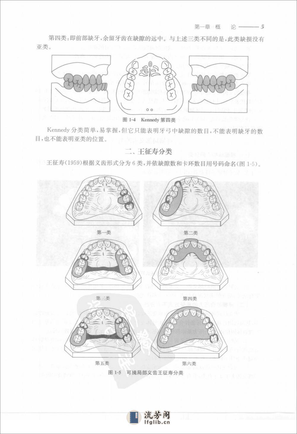 可摘局部义齿修复工艺技术 - 第18页预览图