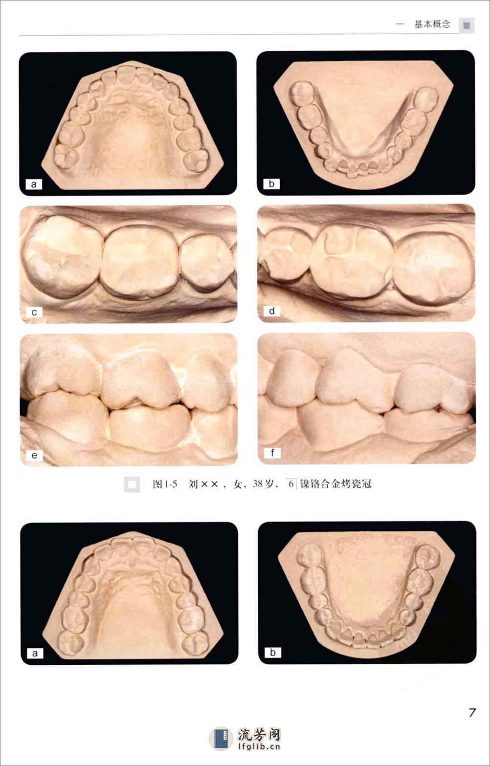 后牙冠桥的合接触_徐军2010（彩图） - 第16页预览图