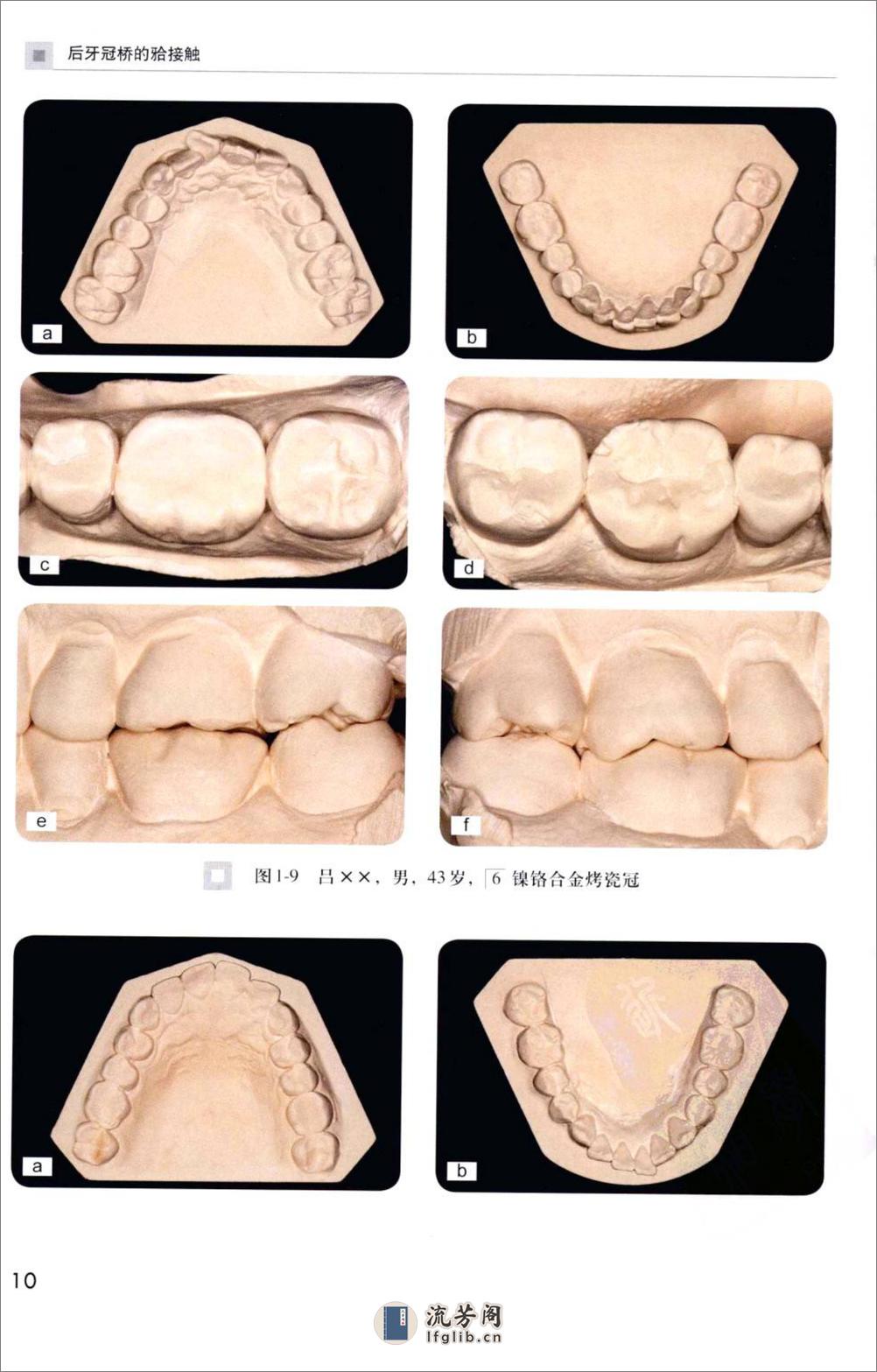 后牙冠桥的合接触_徐军2010（彩图） - 第19页预览图