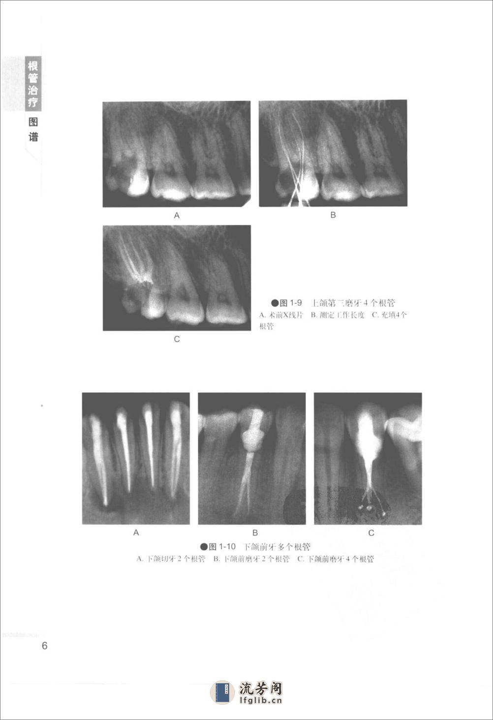 根管治疗图谱 - 第13页预览图