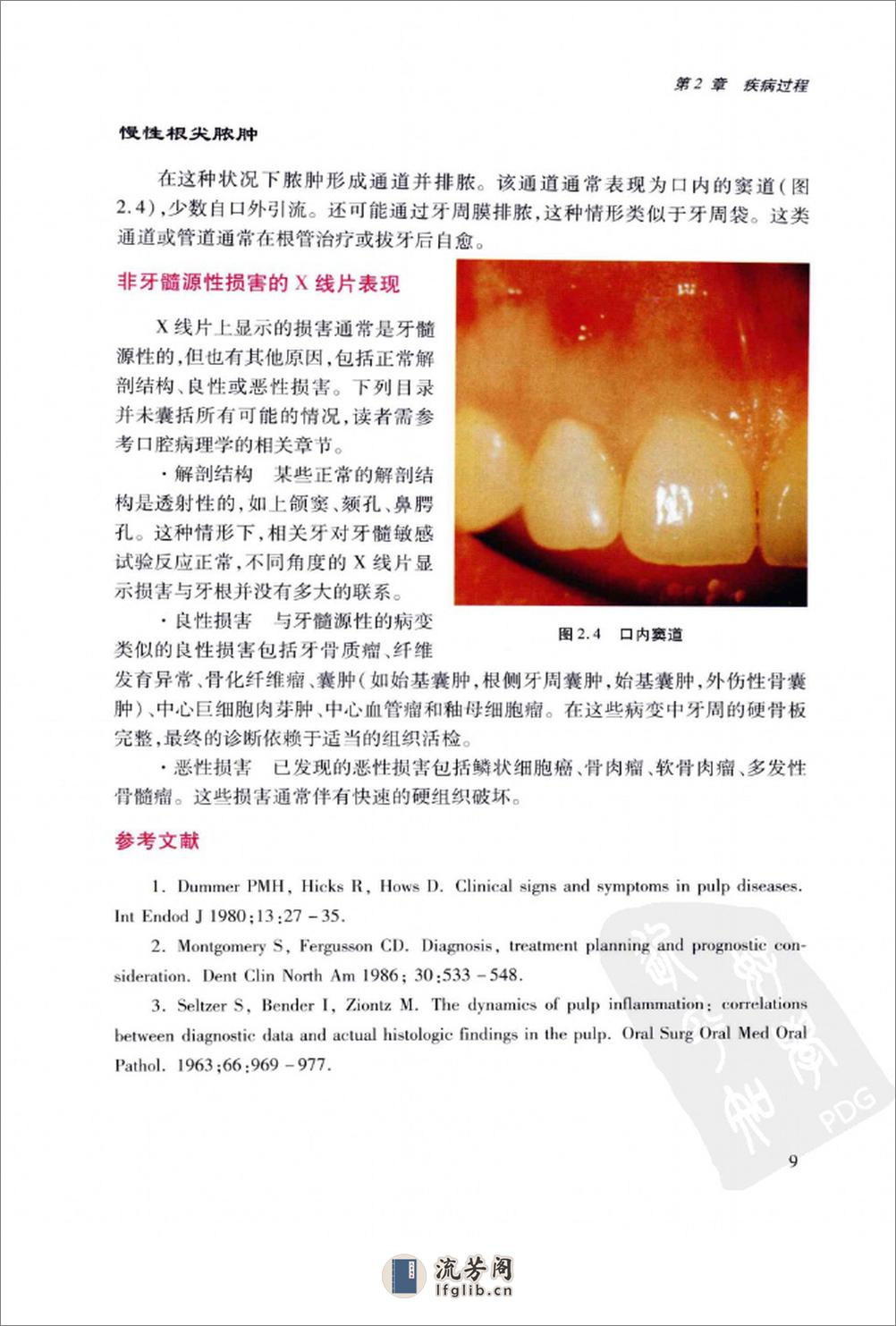 临床实用牙髓病学++牙科最新进展_12773659_... - 第17页预览图