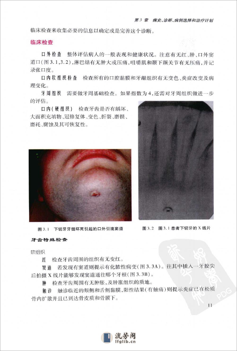 临床实用牙髓病学++牙科最新进展_12773659_... - 第19页预览图