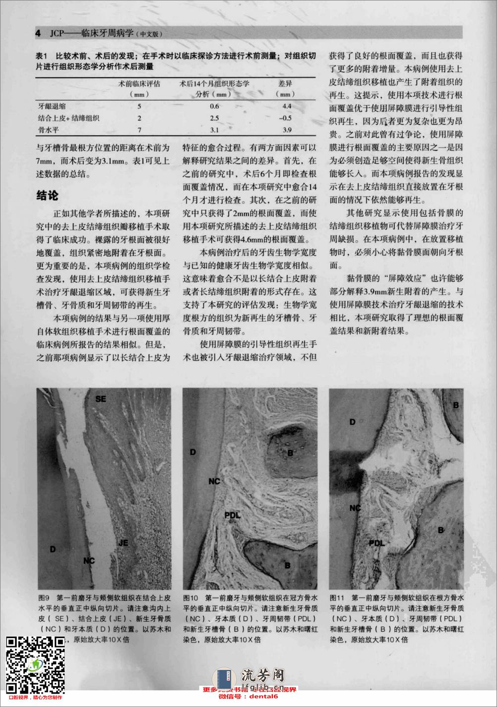 临床牙周病学  根面覆盖与牙周组织再生专辑  中文版_13284740_（意）托尼提主编 - 第7页预览图