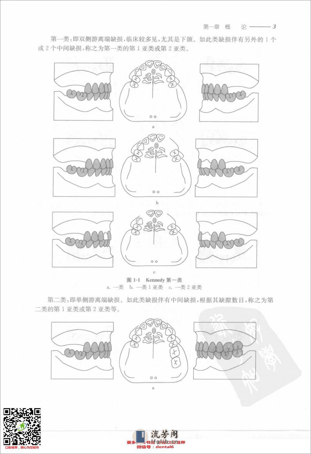 可摘局部义齿修复工艺技术 - 第16页预览图