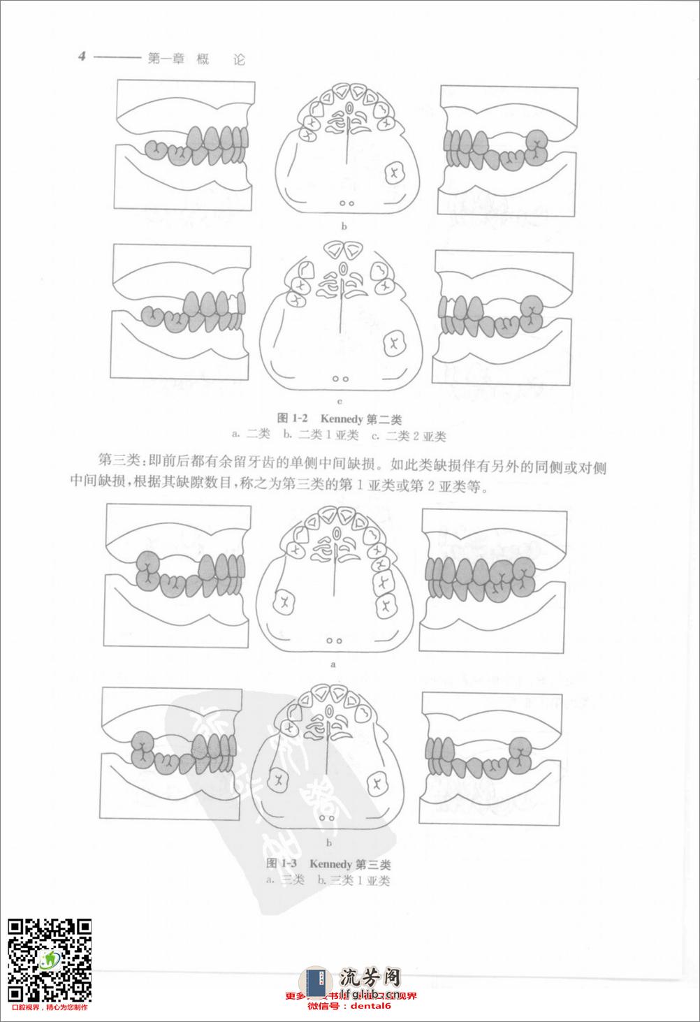 可摘局部义齿修复工艺技术 - 第17页预览图