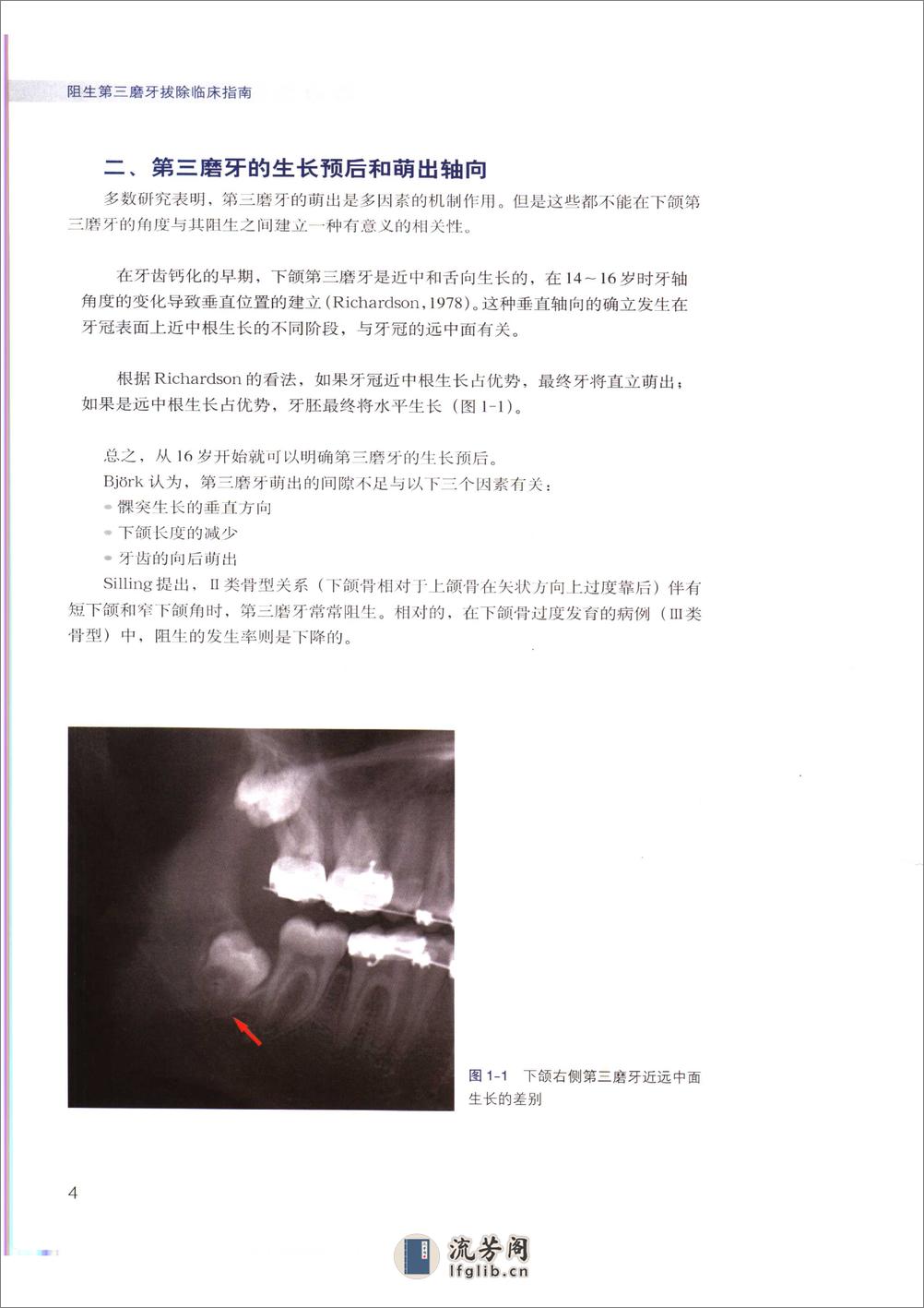 阻生第三磨牙拔除临床指南 - 第11页预览图