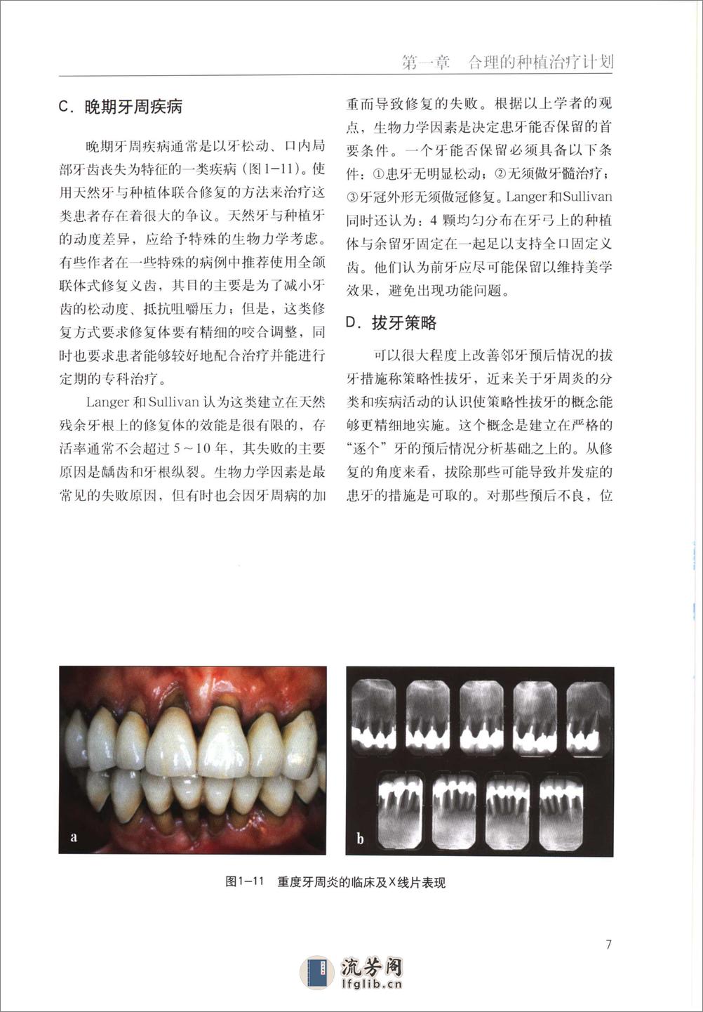 国际牙科名著系列—口腔种植学临床操作指南 - 第16页预览图