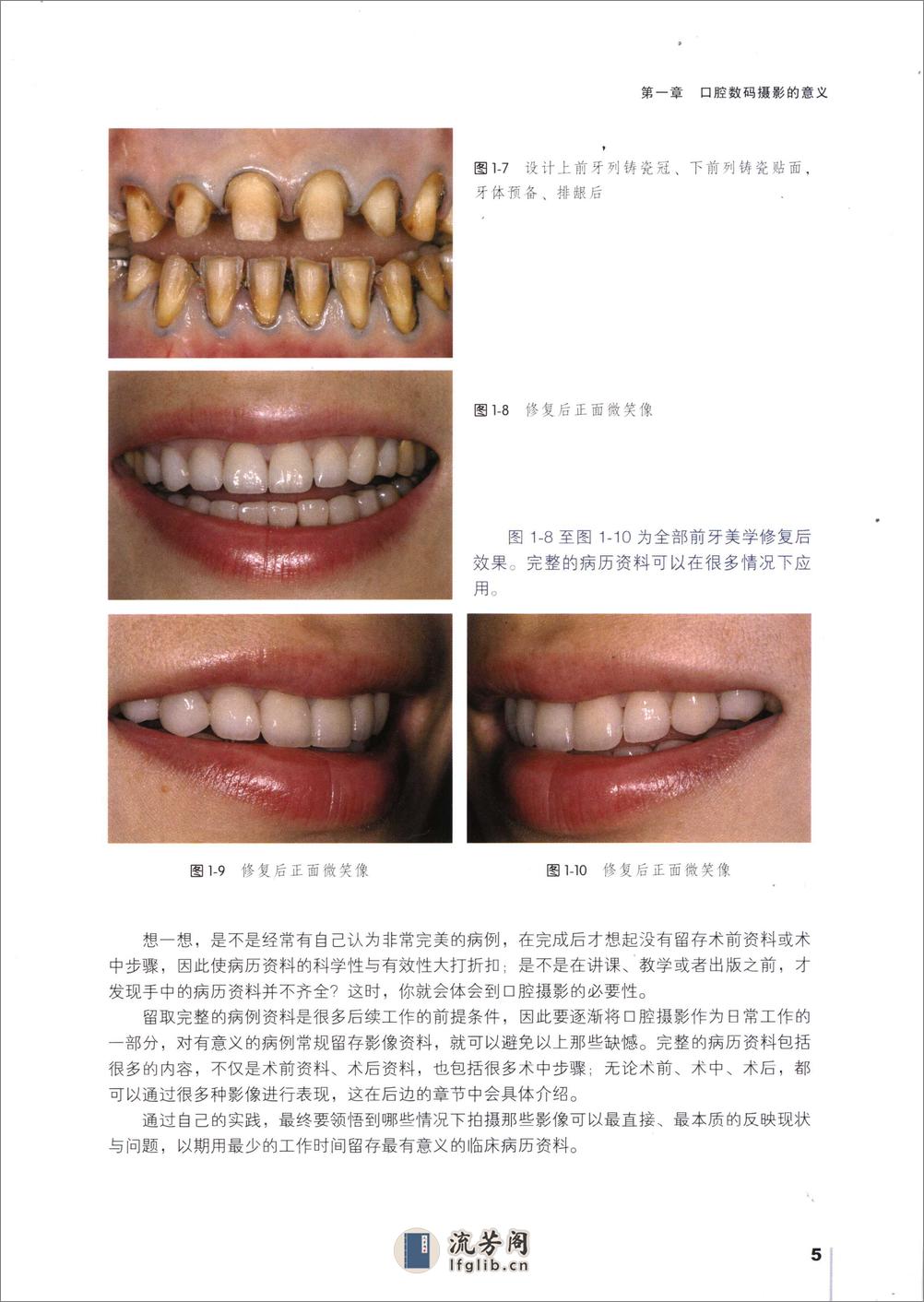 口腔数码摄影 - 第19页预览图