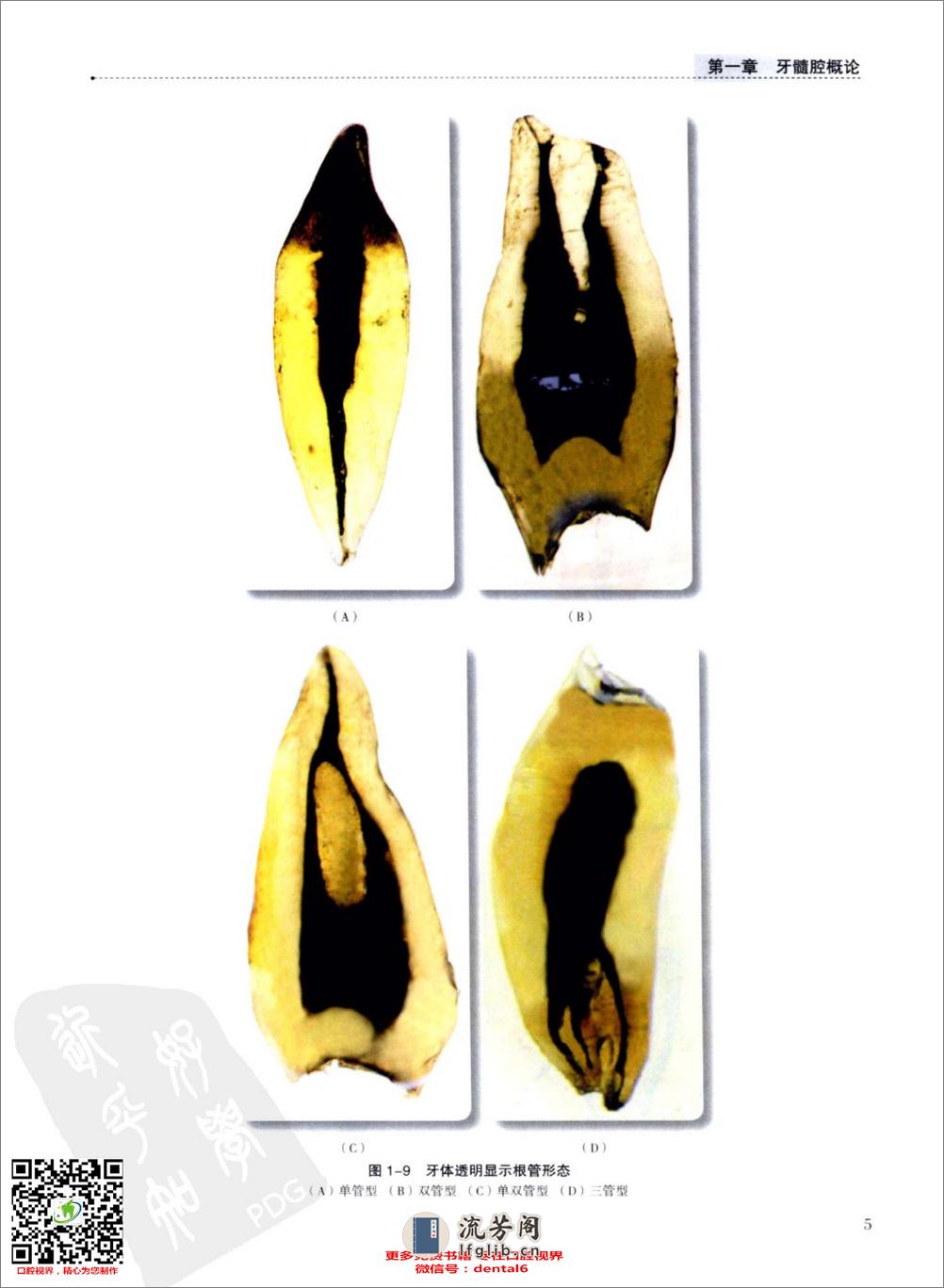实用牙髓腔解剖学  供口腔医学类专业用_13186671 - 第15页预览图