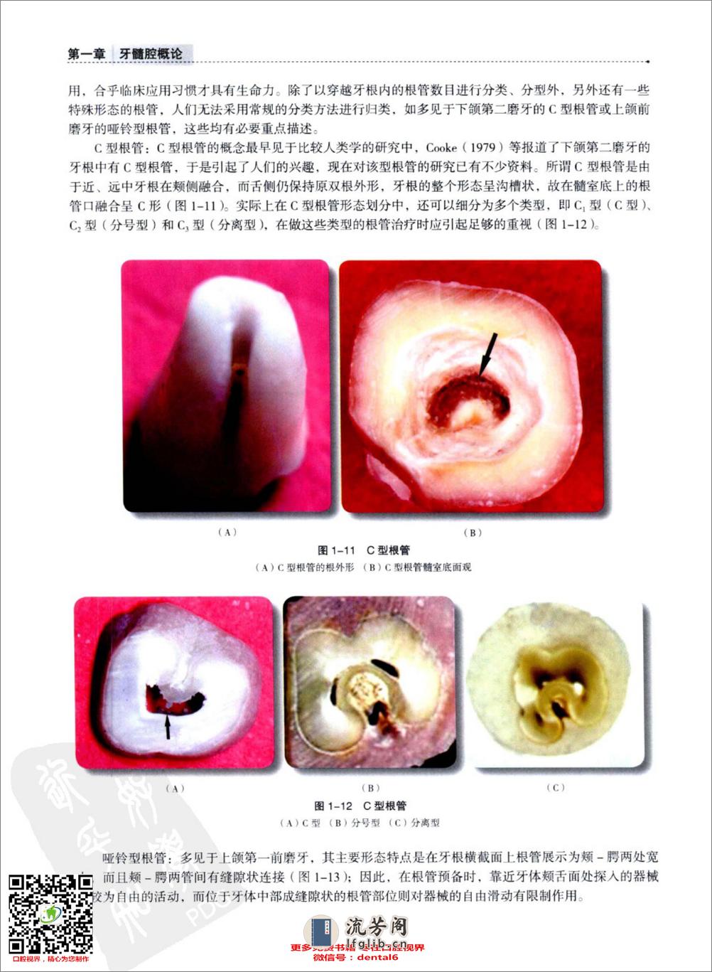 实用牙髓腔解剖学  供口腔医学类专业用_13186671 - 第18页预览图