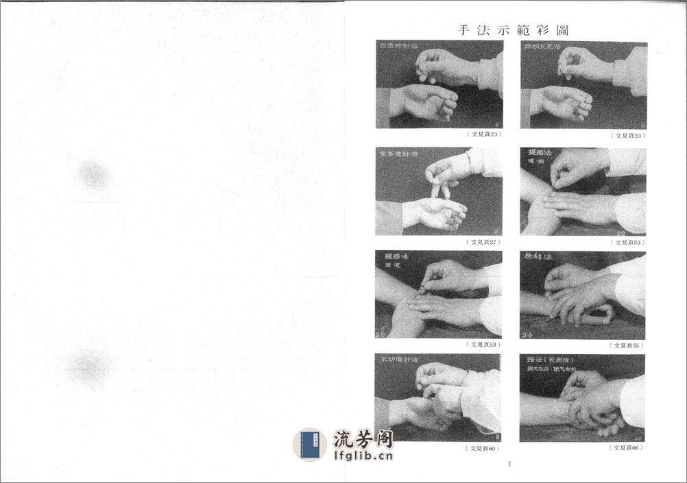 图说针刺手法120种 - 第2页预览图