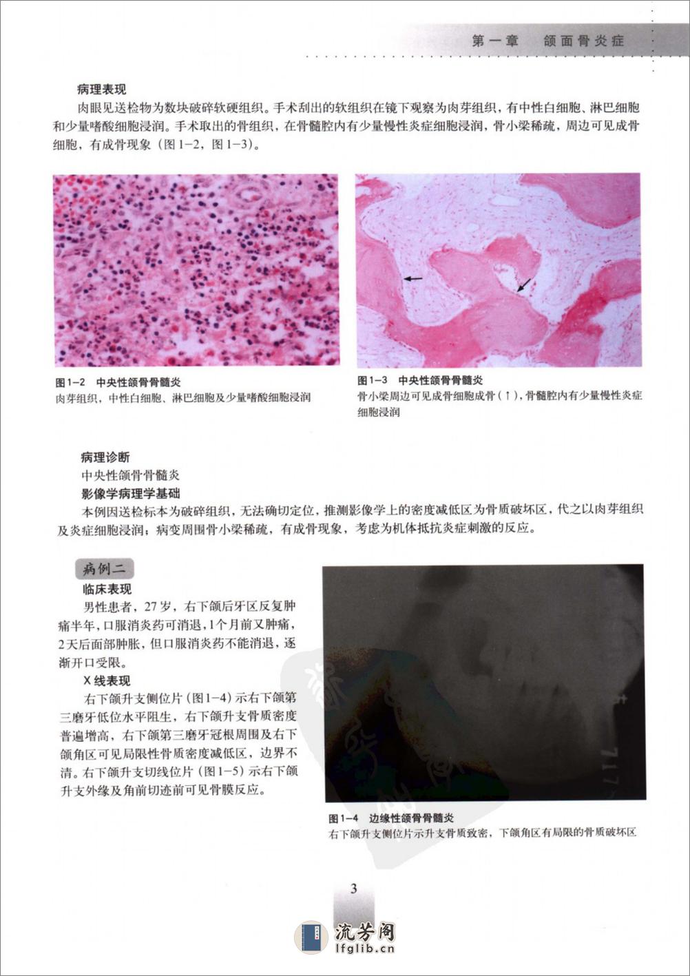 口腔颌面疾病临床X线表现及其病理学基础_1... - 第17页预览图