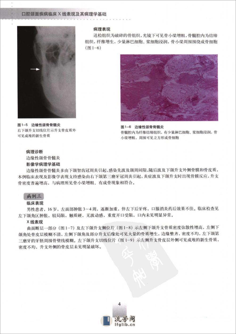 口腔颌面疾病临床X线表现及其病理学基础_1... - 第18页预览图