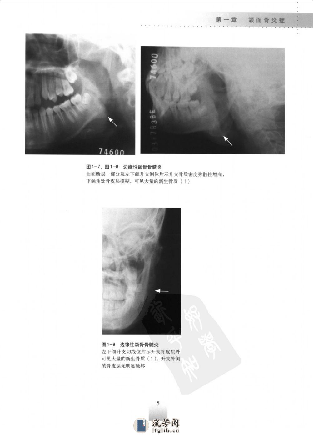 口腔颌面疾病临床X线表现及其病理学基础_1... - 第19页预览图