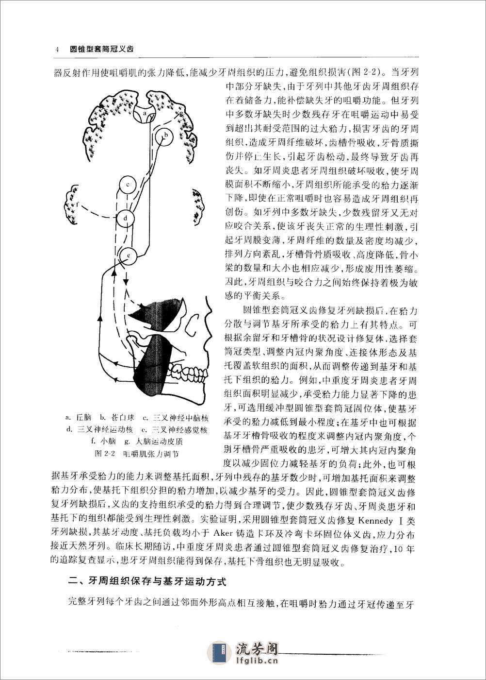 圆锥型套筒冠义齿_10855179 - 第11页预览图