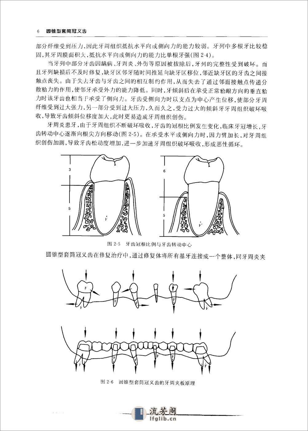 圆锥型套筒冠义齿_10855179 - 第13页预览图