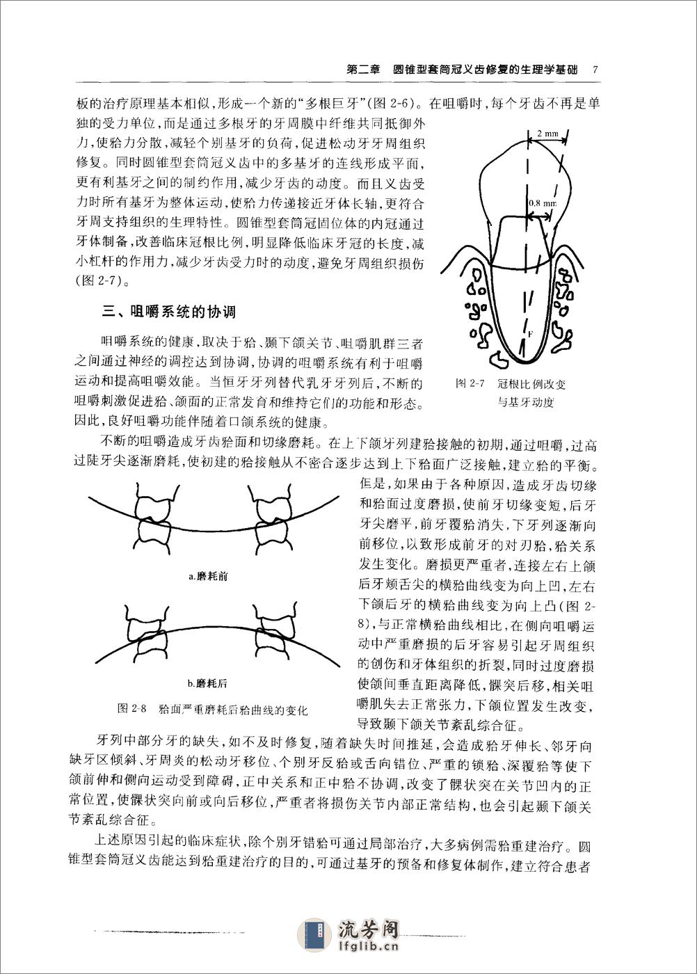 圆锥型套筒冠义齿_10855179 - 第14页预览图