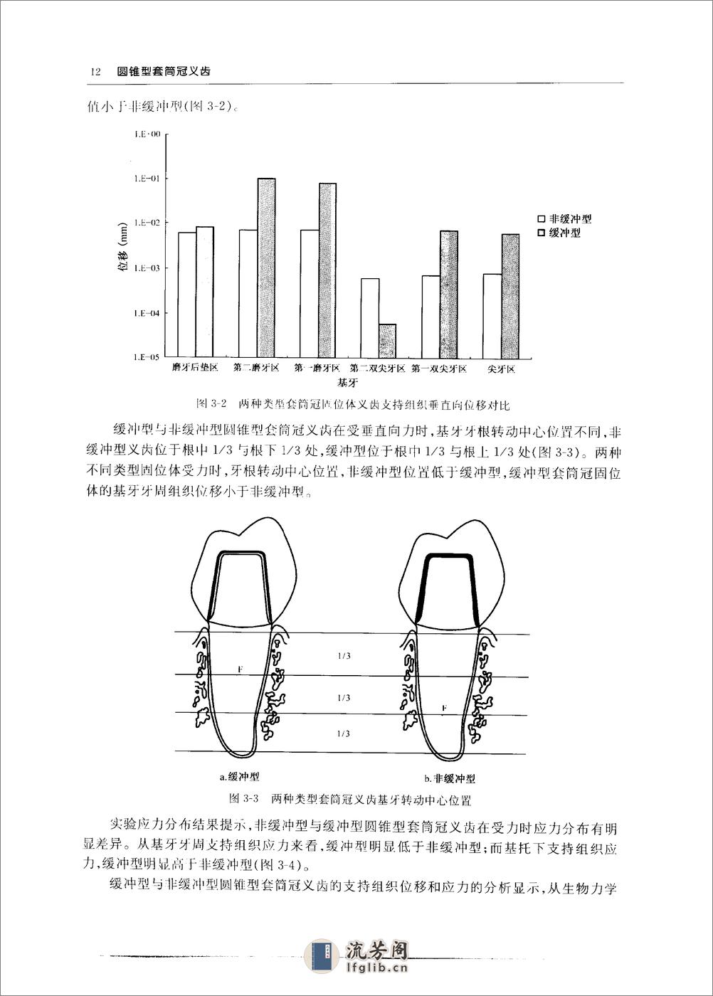 圆锥型套筒冠义齿_10855179 - 第19页预览图