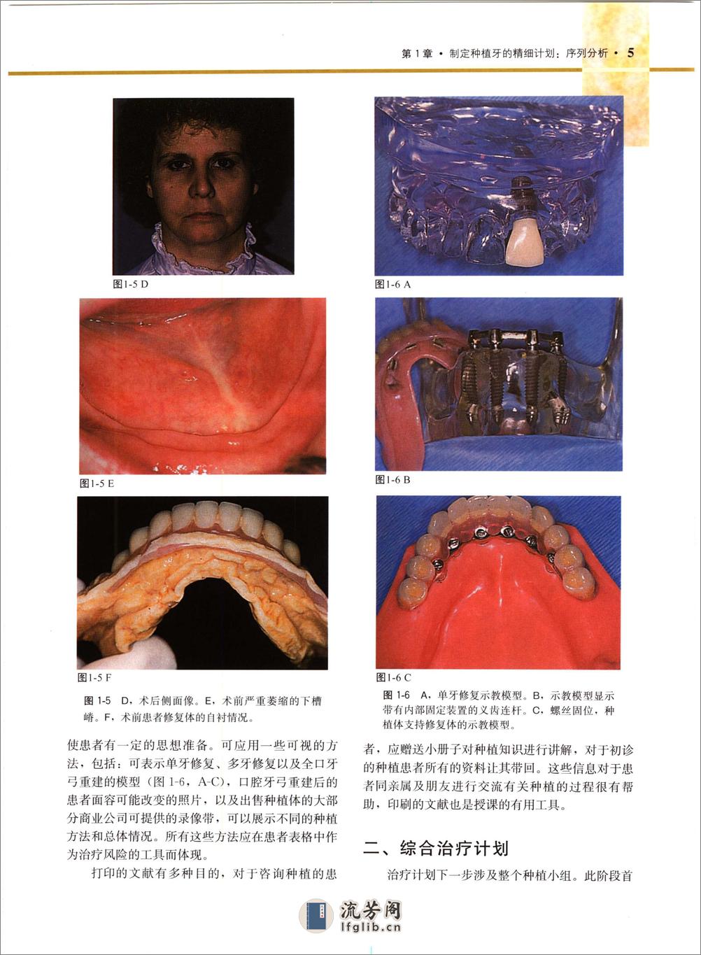 牙种植技术 艺术与科学 - 第13页预览图