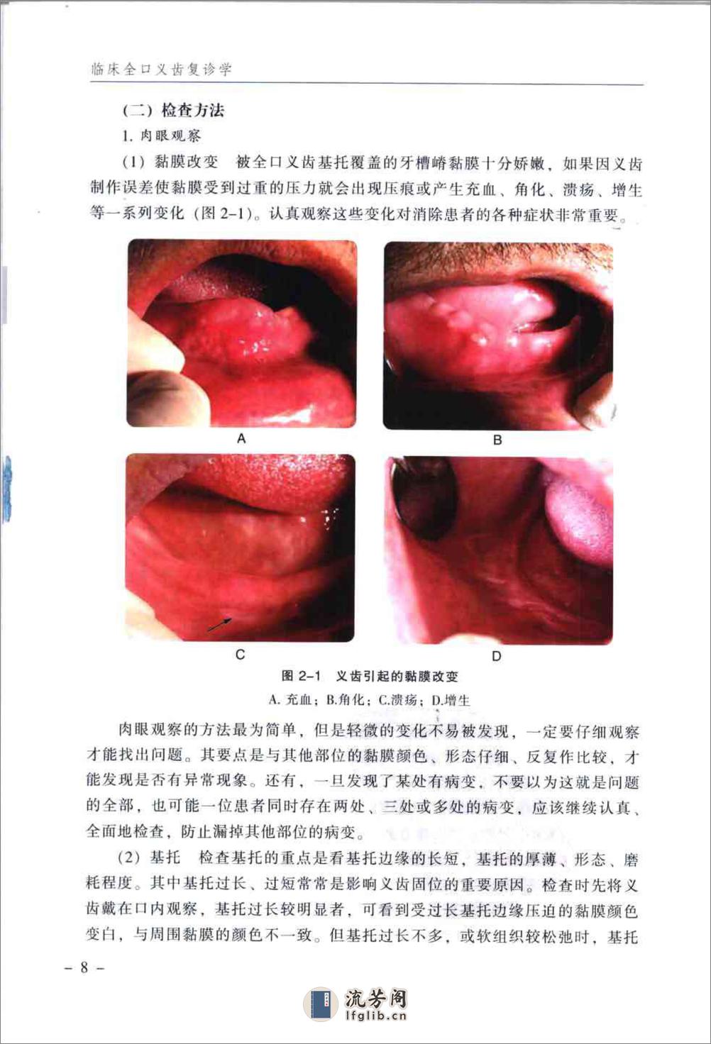 临床全口义齿复诊学_郭天文2009-2x - 第12页预览图