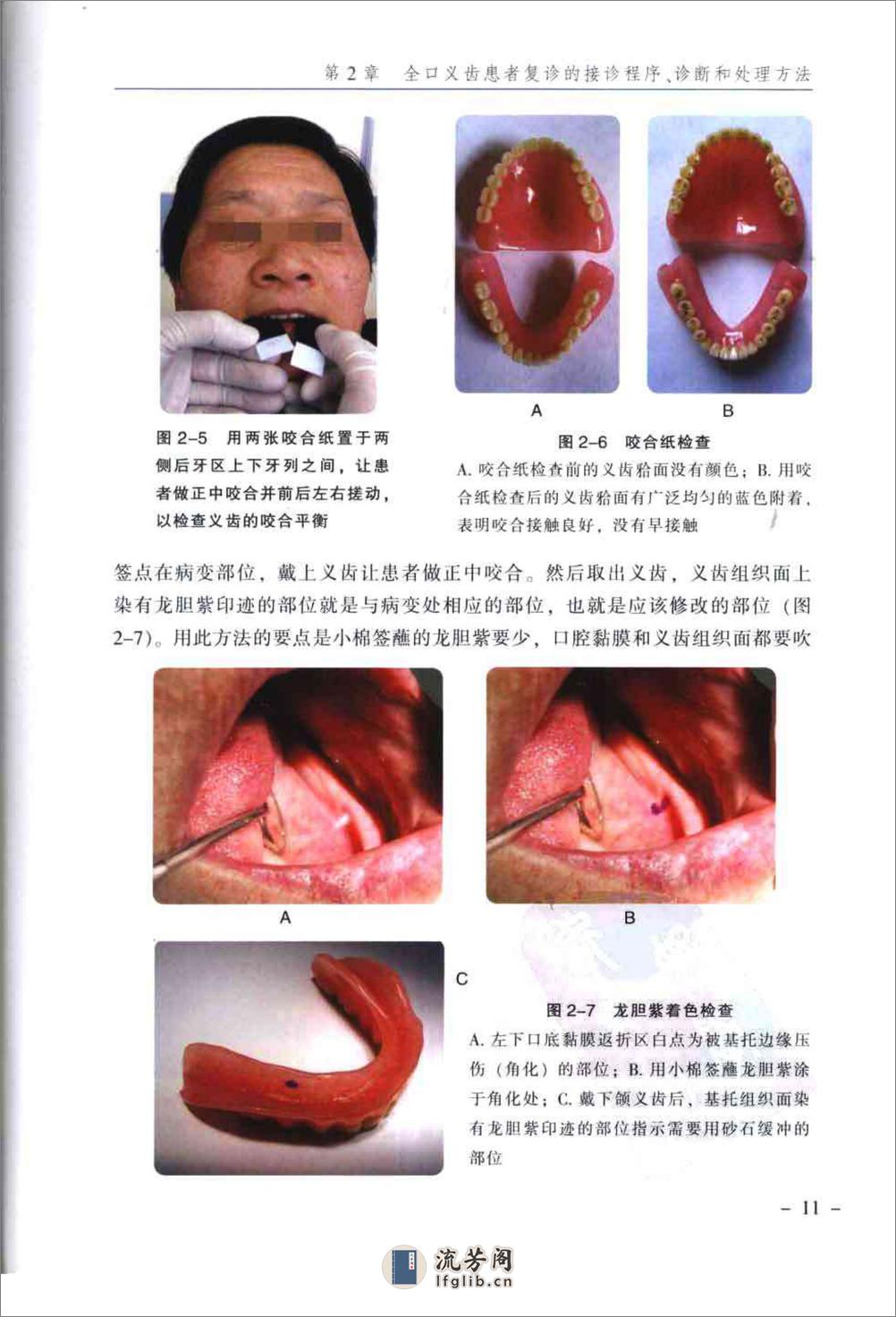 临床全口义齿复诊学_郭天文2009-2x - 第15页预览图