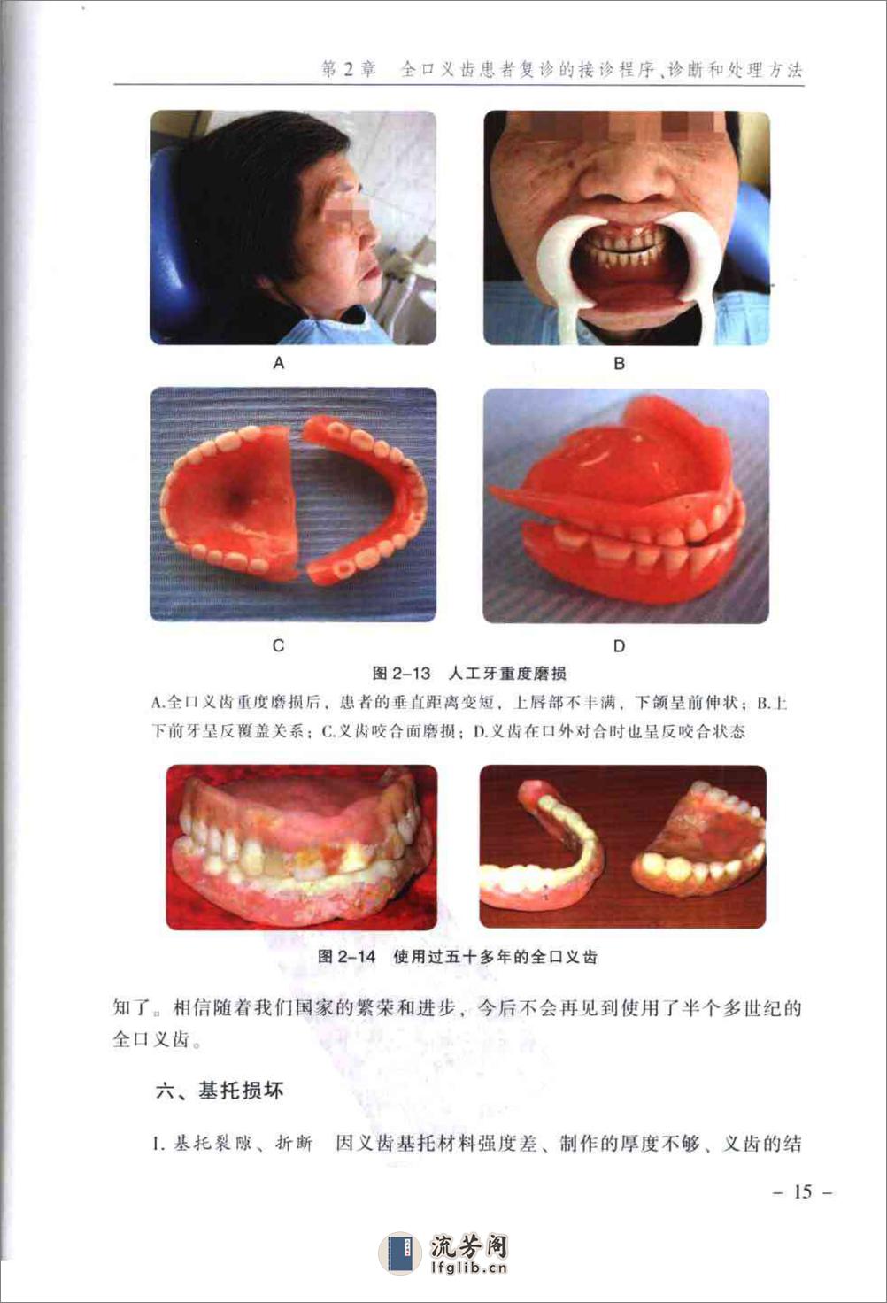 临床全口义齿复诊学_郭天文2009-2x - 第19页预览图