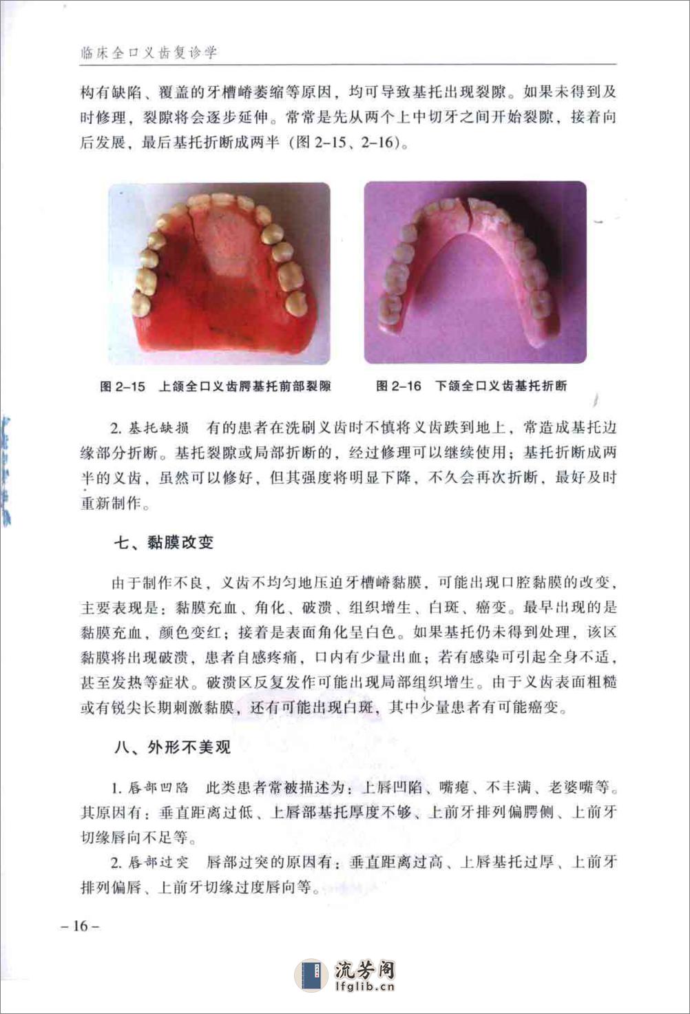 临床全口义齿复诊学_郭天文2009-2x - 第20页预览图