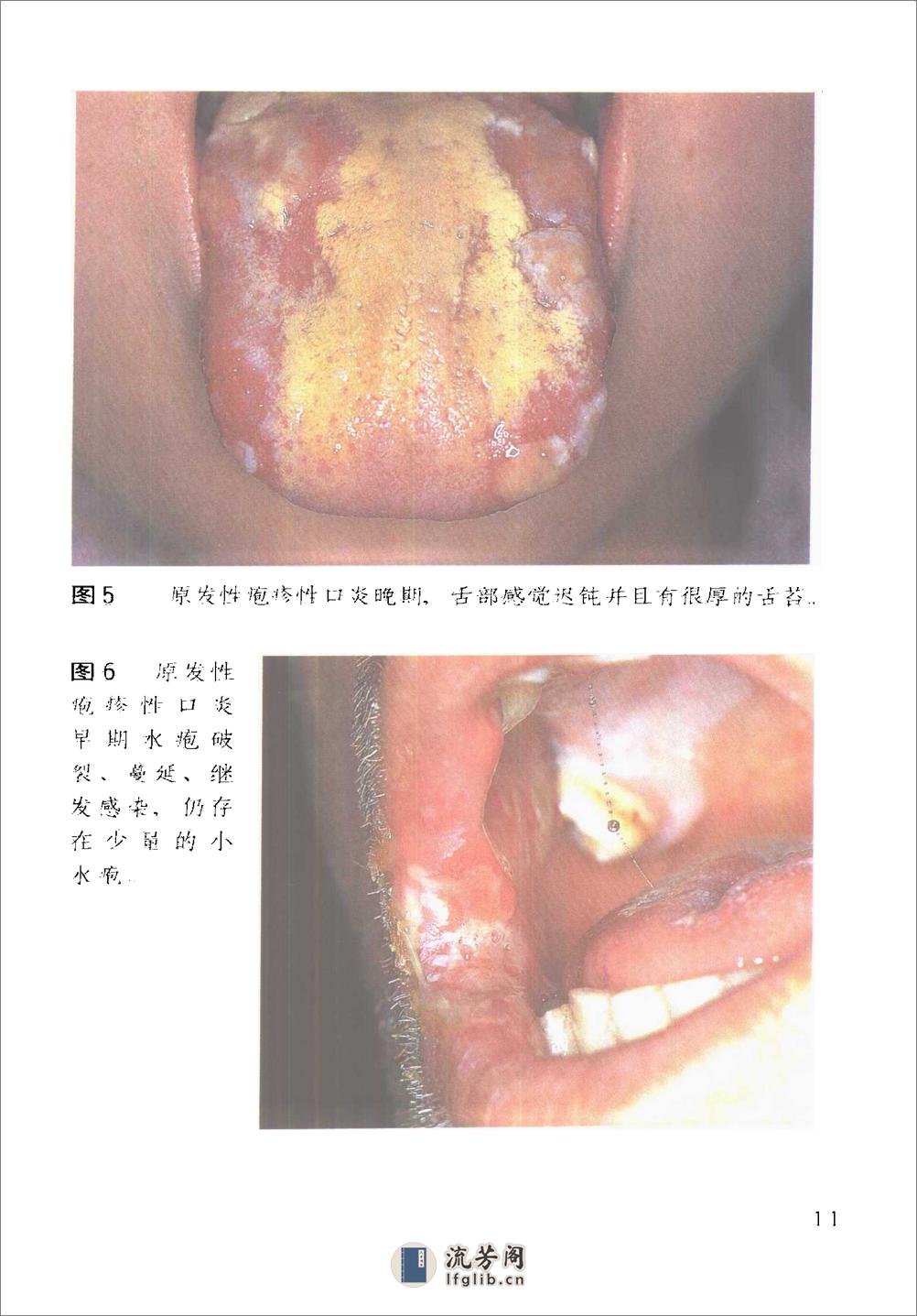 口腔内科学诊断彩色图谱 - 第14页预览图