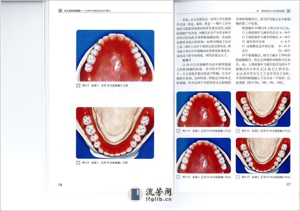 全口义齿合型 - 第14页预览图