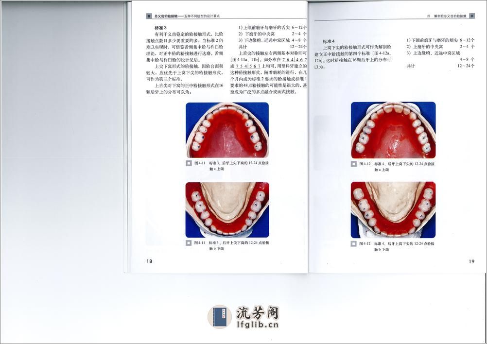 全口义齿合型 - 第15页预览图