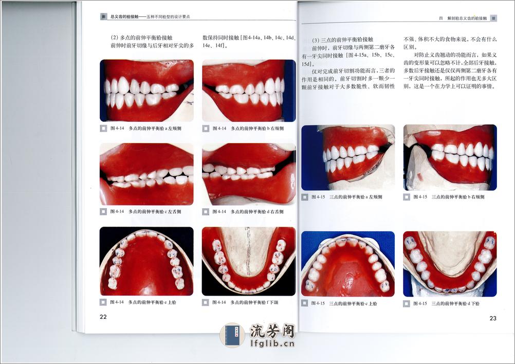 全口义齿合型 - 第17页预览图