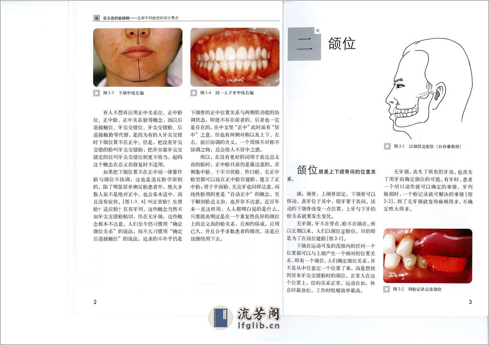 全口义齿合型 - 第7页预览图