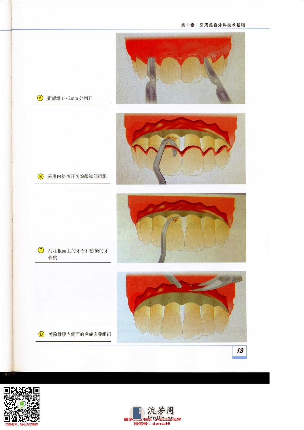 牙周美容外科技术基础 - 第13页预览图
