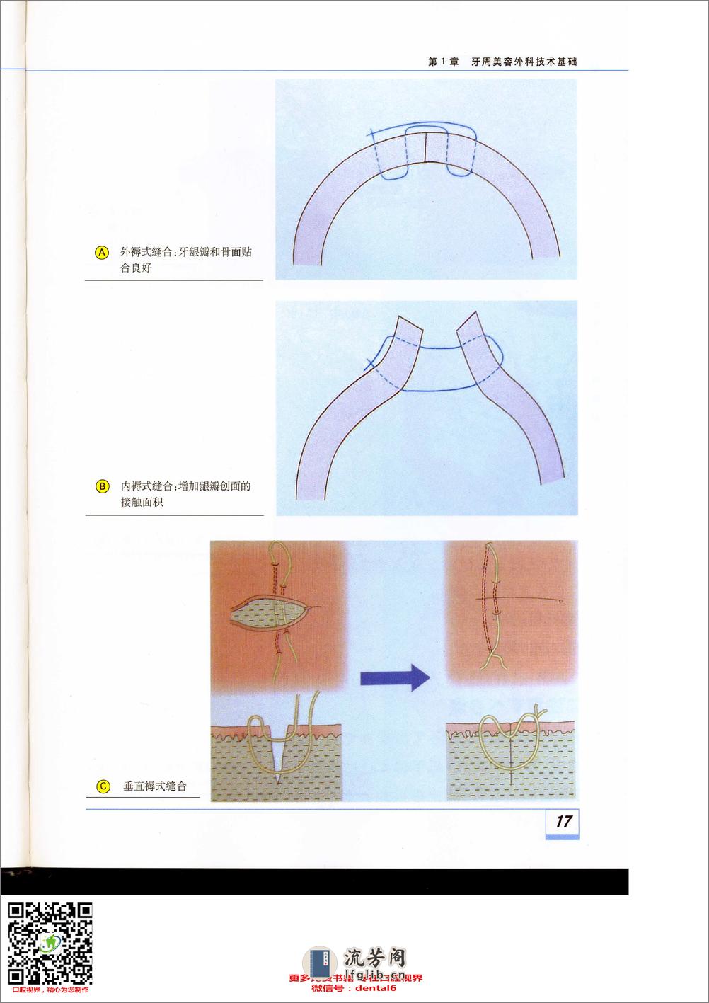 牙周美容外科技术基础 - 第17页预览图