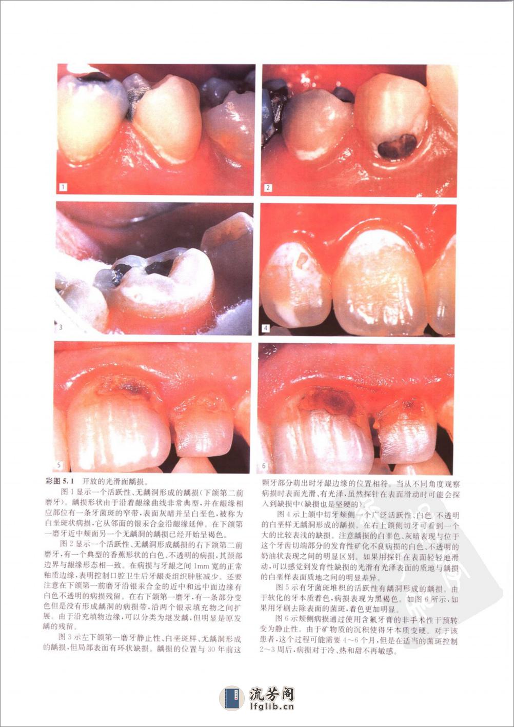 龋病学：疾病及其临床处理 - 第13页预览图