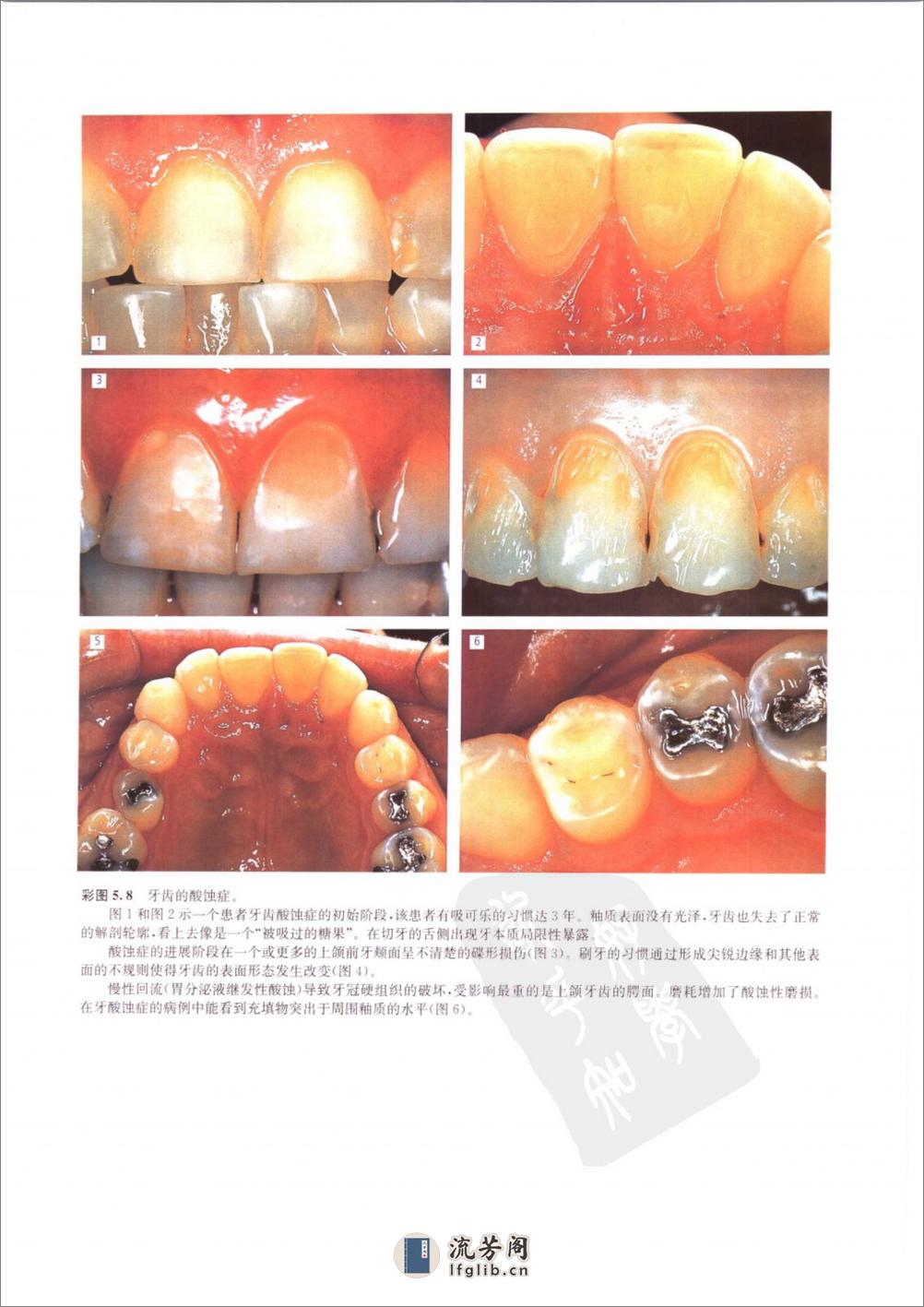 龋病学：疾病及其临床处理 - 第20页预览图