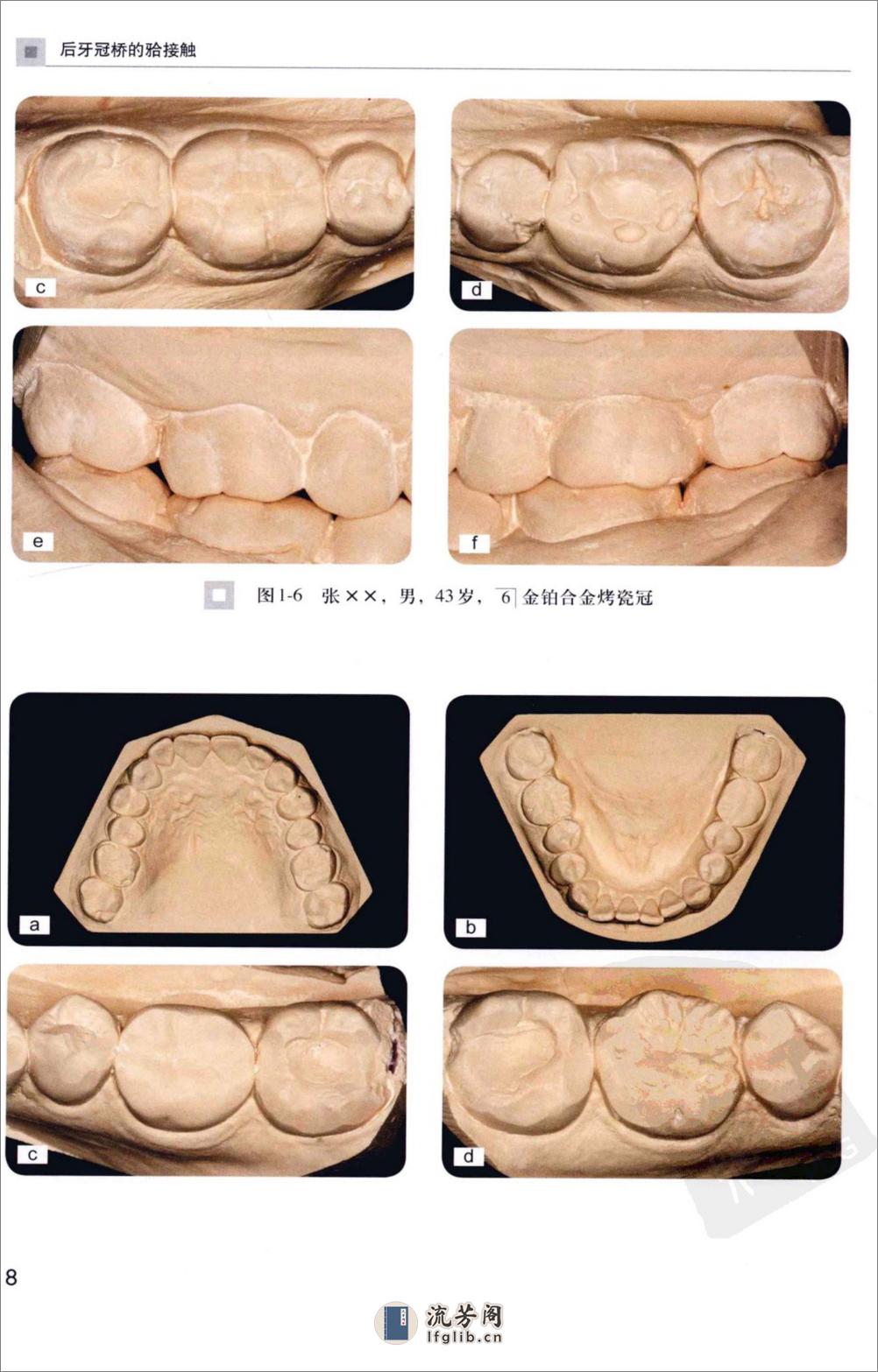 后牙冠桥的合接触_徐军2010（彩图） - 第17页预览图