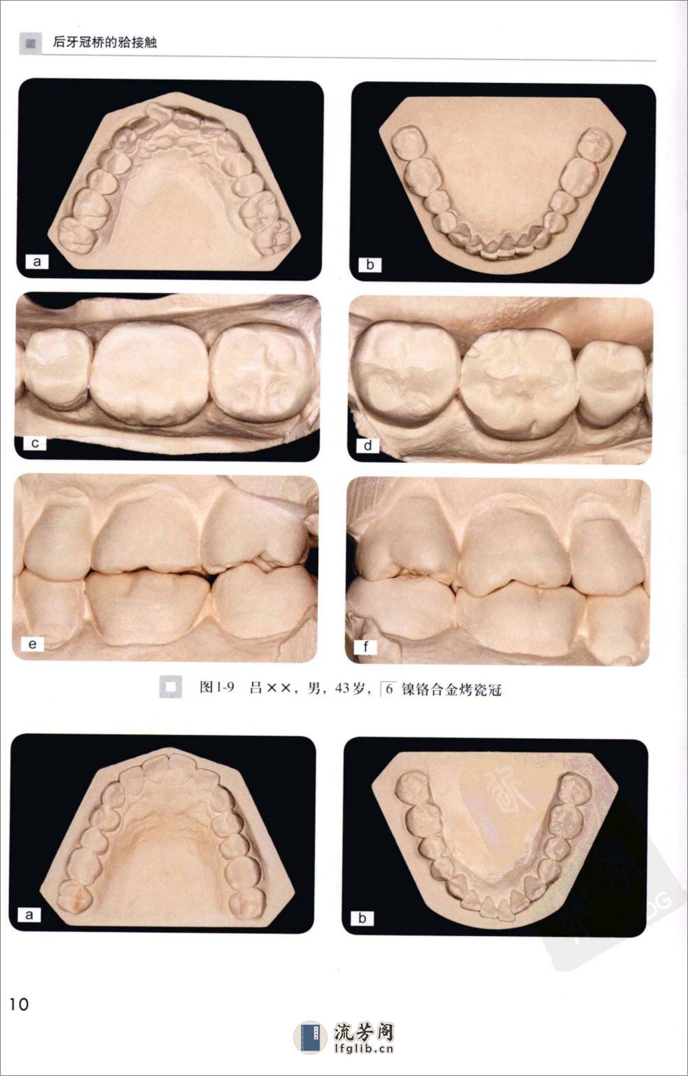 后牙冠桥的合接触_徐军2010（彩图） - 第19页预览图