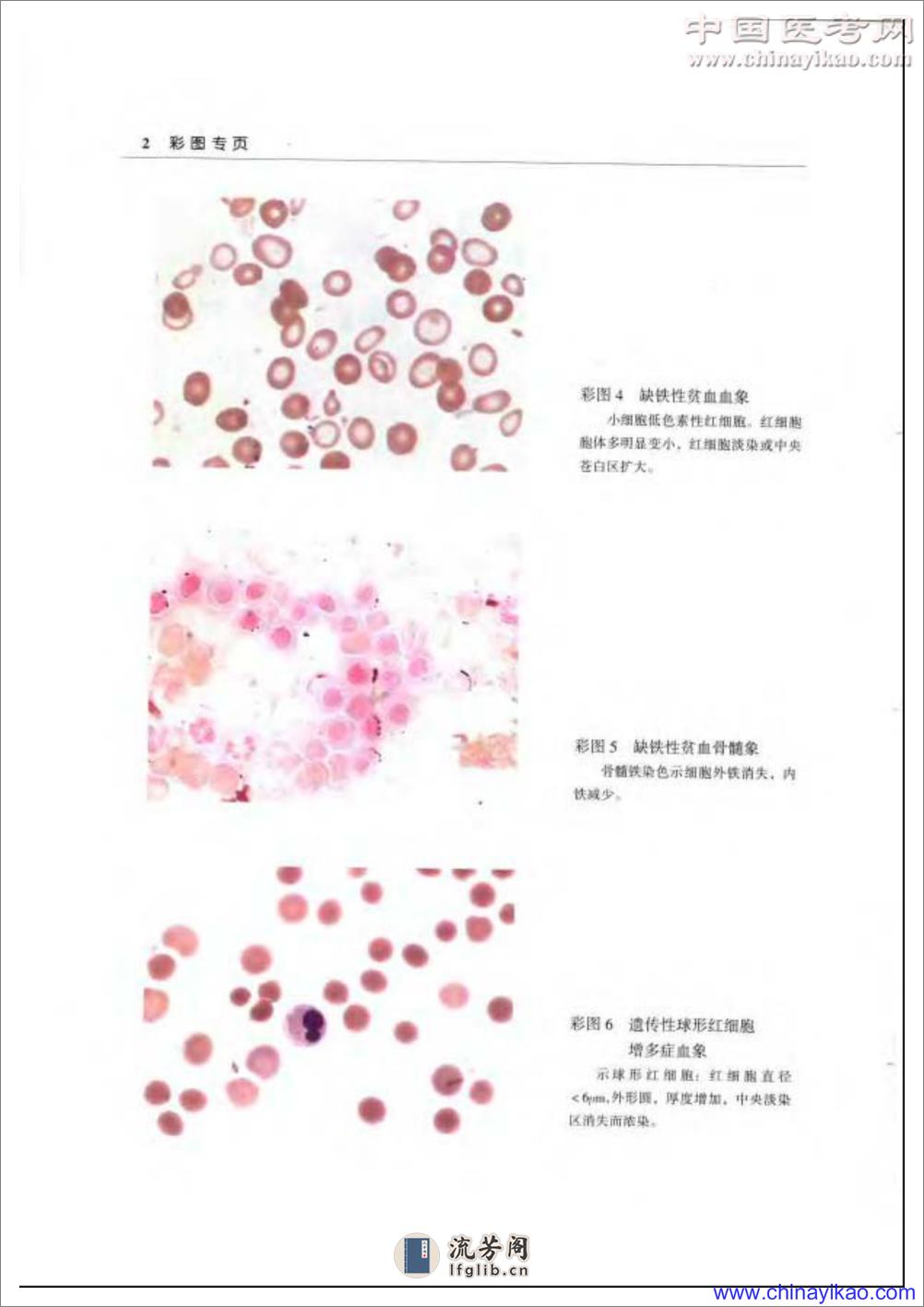 协和血液病学——张之南 单渊东-2004 - 第7页预览图