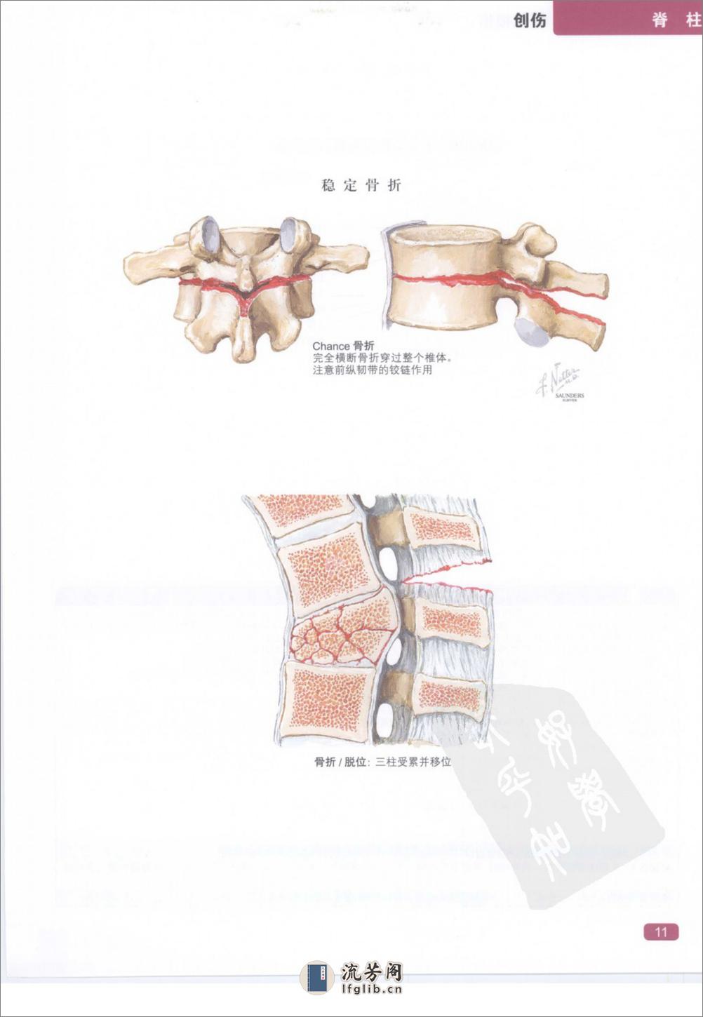 奈特简明骨科学彩色图谱（高清中文版） - 第19页预览图