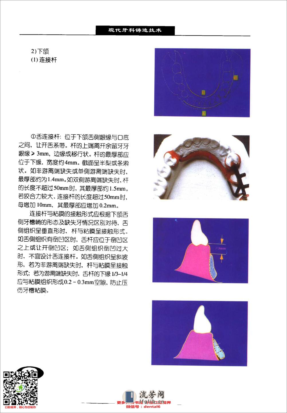 现代牙科铸造技术%2B可摘局部义齿铸造支架制.... - 第17页预览图