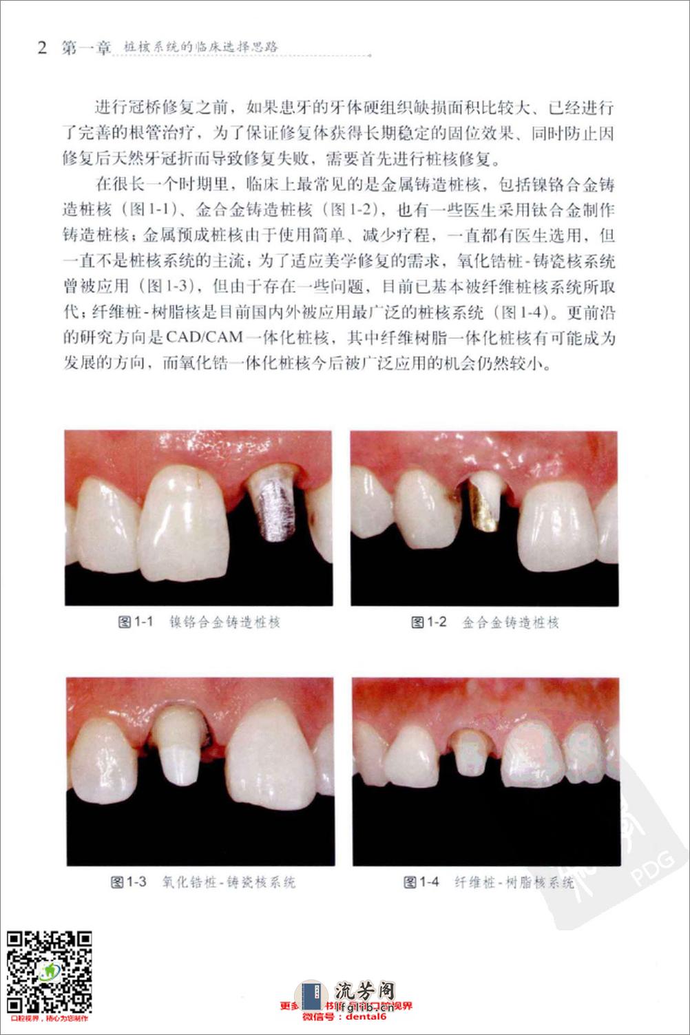 纤维桩修复技术_13192342 - 第12页预览图