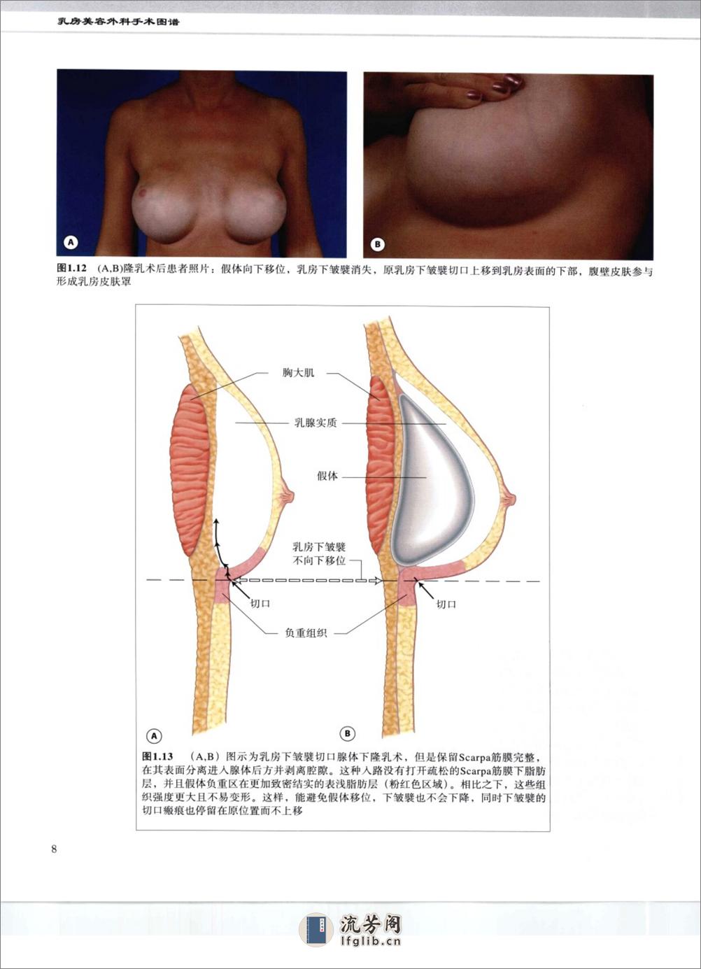 乳房美容外科手术图谱 - 第16页预览图