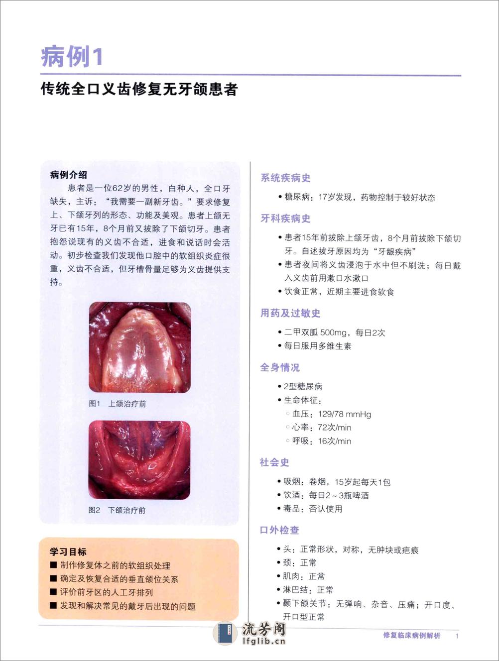 修复临床病例解析 - 第16页预览图